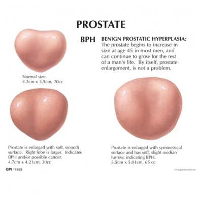Vyrų dubens modelis su prostata