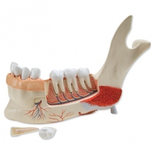 Priešakinė apatinio žandikaulio pusė su 8 nesveikais dantimis, 19 dalių