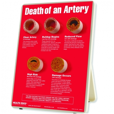 Stovas „Arterijų mirtis”