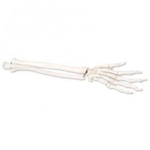 Dalinai sutvirtintas rankos skeletas su alkūnkauliu ir stipinkauliu