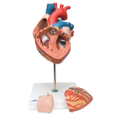 Dvigubo dydžio širdies modelis, 4 dalys 1