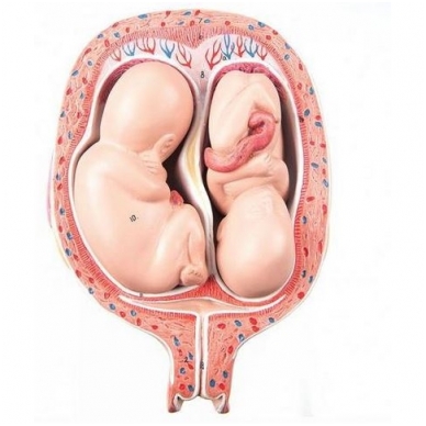 Dvynukų embrionų modelis (5 mėnesiai, normali pozicija)