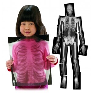 Edukacinių rentgeno nuotraukų rinkinys ,,Skeletas"
