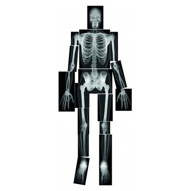 Edukacinių rentgeno nuotraukų rinkinys ,,Skeletas" 1