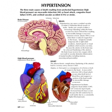Hipertenzijos mini modelių rinkinys 1