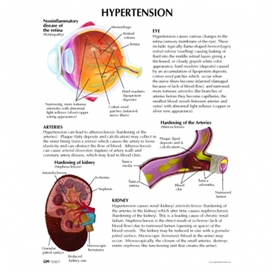 Hipertenzijos mini modelių rinkinys 2