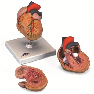 Klasikinis širdies modelis su kairiojo skilvelio hipertrofija, 2 dalys