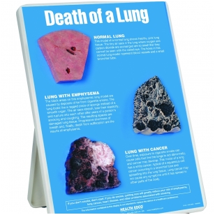 Stovas „Plaučių mirtis”