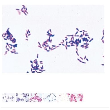 Preparatų rinkinys mikroskopui  "Patogeninės bakterijos",  25 vnt.