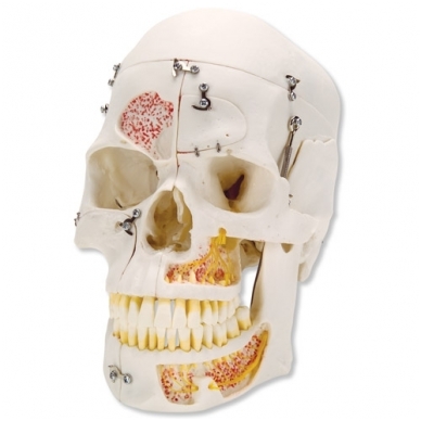 Prabangus demonstracinis žmogaus dantinės kaukolės modelis, 10 dalių 1