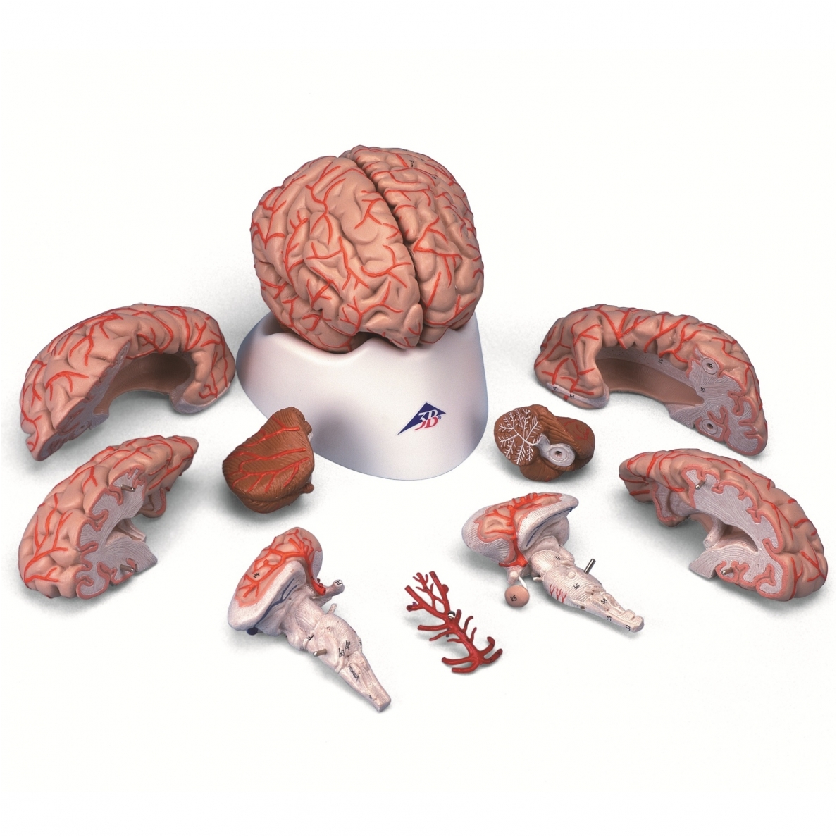 Smegenys su arterijomis, 9 dalys
