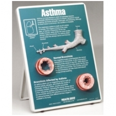 Stovas „Astma”