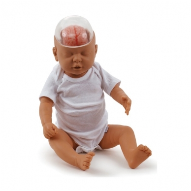 "Supurtyto kūdikio sindromas" demonstracinis modelis 1