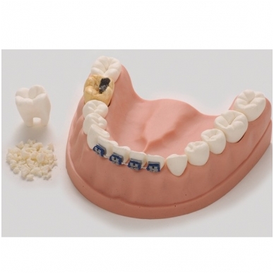 Sveikų dantų modelis 1