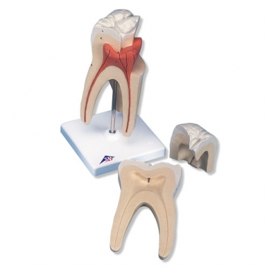 Viršutinio krūminio danties su triguba šaknimi modelis, 3 dalys