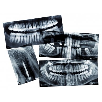 Žmogaus dantų rentgeno nuotraukų rinkinys
