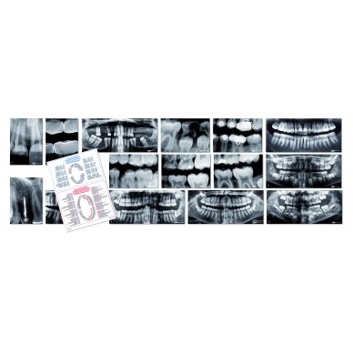 Žmogaus dantų rentgeno nuotraukų rinkinys 5